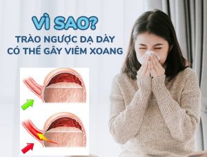 VÌ Sao TrÀo NgƯỢc DẠ DÀy CÓ ThỂ GÂy ViÊm Xoang