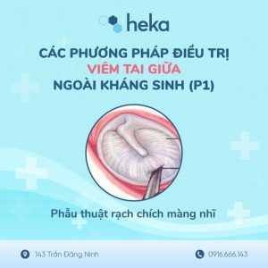 CÁc PhƯƠng PhÁp ĐiỀu TrỊ ViÊm Tai GiỮa KhÁc NgoÀi KhÁng Sinh