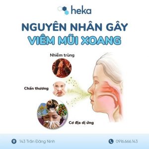 Nguyên Nhân Gây Viêm Mũi Xoang ở Trẻ Em Và Người Lớn