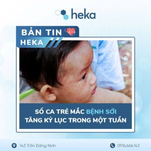 Số Trẻ Mắc Sởi Tăng Kỉ Lục Trong 1 Tuần