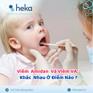 So Sánh Viêm Amidan Và Viêm Va: Khác Nhau Ở Điểm Nào?