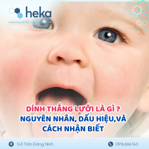 Dính Thắng Lưỡi Là Gì? Nguyên Nhân, Dấu Hiệu Và Cách Nhận Biết