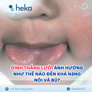 Dính Thắng Lưỡi Ảnh Hưởng Như Thế Nào Đến Khả Năng Nói Và Bú?