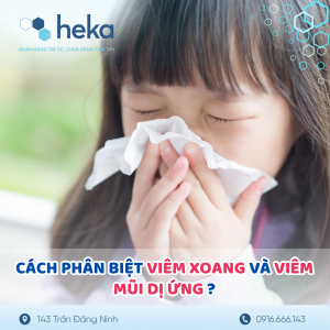 Cách Phân Biệt Viêm Xoang Và Viêm Mũi Dị Ứng