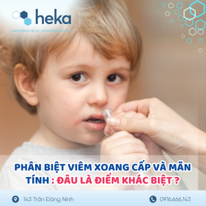 Phân Biệt Viêm Xoang Cấp Và Mãn Tính: Đâu Là Điểm Khác Biệt ?