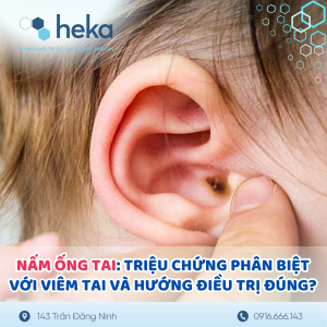 Nấm Ống Tai: Triệu Chứng, Phân Biệt Với Viêm Tai Và Hướng Điều Trị Đúng