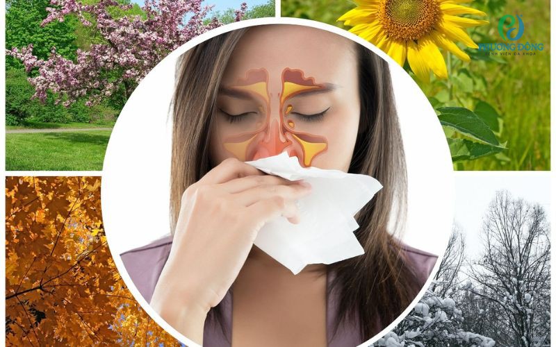 Viêm xoang dị ứng: Nguyên nhân, triệu chứng, chẩn đoán và điều trị