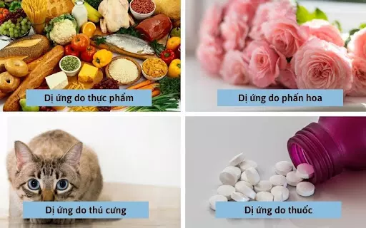 Tổng quan về các loại dị ứng và cách giảm mẩn ngứa, khó chịu