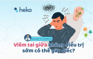 Giải đáp Từ Chuyên Gia: Viêm Tai Giữa Không điều Trị Sớm Có Thể Gây điếc?