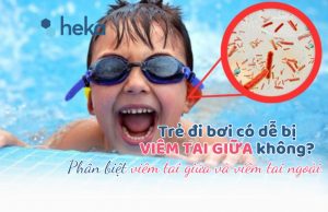Trẻ đi Bơi Có Dễ Bị Viêm Tai Giữa Không? Phân Biệt Viêm Tai Giữa Và Viêm Tai Ngoài