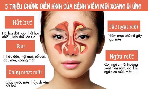 Tổng hợp những thông tin về viêm mũi dị ứng chuẩn xác nhất - Phòng khám chuyên khoa tai-mũi -họng