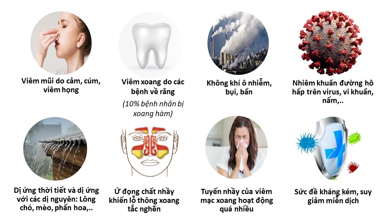 Viêm xoang những điều cần biết Phòng khám Đông y Phúc Thành