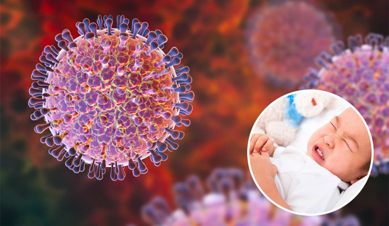 Bệnh do virus ở trẻ: Những biểu hiện cha mẹ cần biết