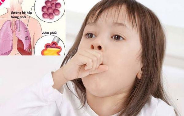 Viêm phổi do virus ở trẻ em kéo dài bao lâu thì khỏi bệnh?