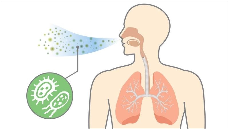 Nhiễm virus hợp bào hô hấp (RSV): Dấu hiệu và cách điều trị hiệu quả