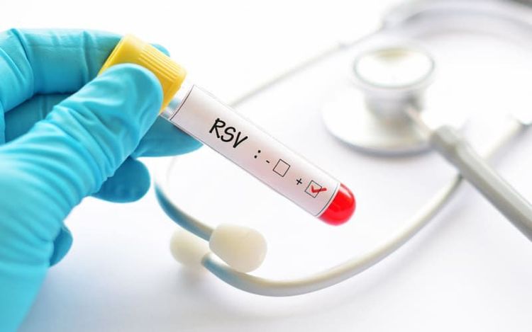 Phân biệt Xét nghiệm RSV: Xét nghiệm kháng nguyên nhanh và rRT-PCR | Vinmec