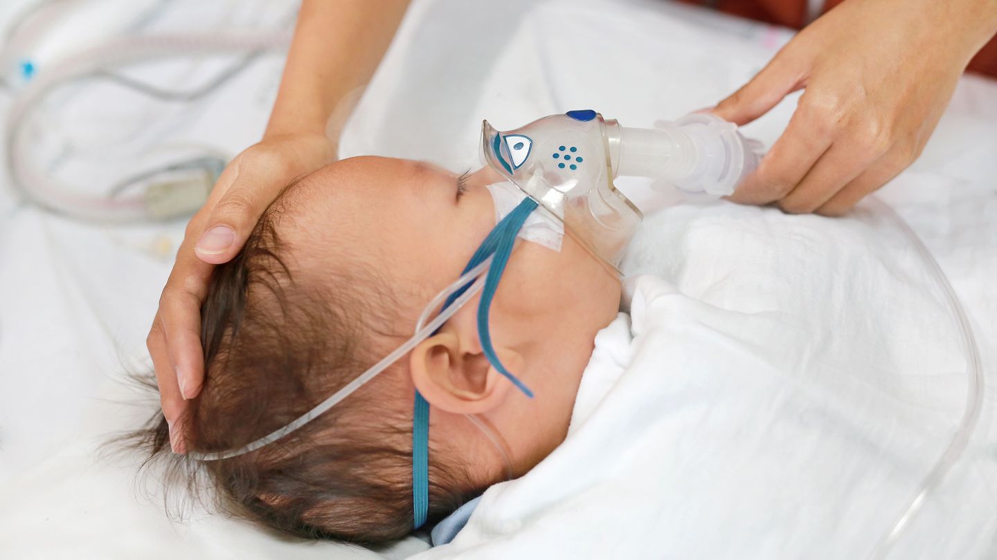 Triệu chứng nhiễm RSV biểu hiện nhiễm RSV ở trẻ