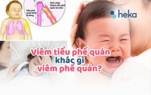 Viêm Tiểu Phế Quản Khác Gì Viêm Phế Quản? Phân Biệt để Tránh Nhầm Lẫn