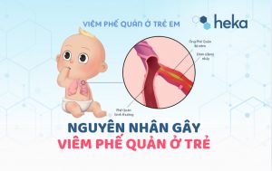Nguyên Nhân Viêm Phế Quản ở Trẻ Giải đáp Từ Chuyên Gia