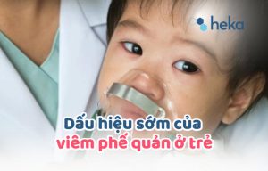 Dấu Hiệu Sớm Của Viêm Phế Quản ở Trẻ