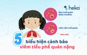 5 Biểu Hiện Cảnh Báo Viêm Tiểu Phế Quản Nặng