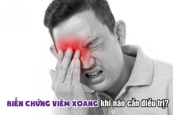 8 Biến Chứng Nguy Hiểm Của Viêm Xoang Không điều Trị