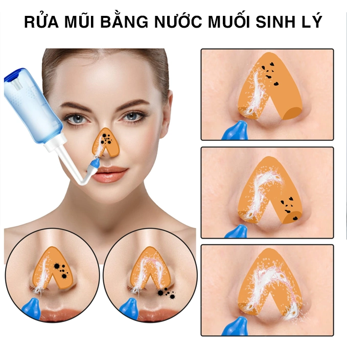 Cách chữa viêm mũi dị ứng tại nhà bằng mẹo dân gian cực nhạy
