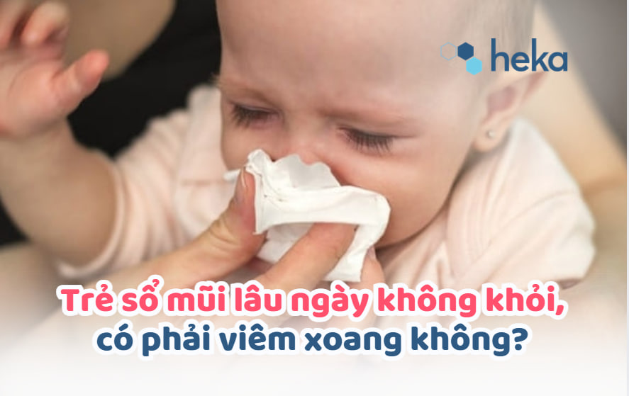 Trẻ Sổ Mũi Lâu Ngày Không Khỏi, Có Phải Viêm Xoang Không?