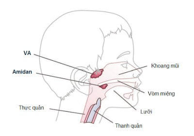 Vai Trò Của Adenoid (va) Trong Viêm Xoang Trẻ Em