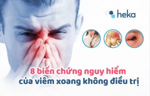 8 Biến Chứng Nguy Hiểm Của Viêm Xoang Không điều Trị