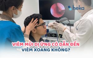 ViÊm MŨi DỊ Ứng CÓ DẪn ĐẾn ViÊm Xoang KhÔng?