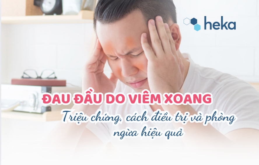 Đau đầu Do Viêm Xoang: Triệu Chứng, Cách điều Trị Và Phòng Ngừa Hiệu Quả