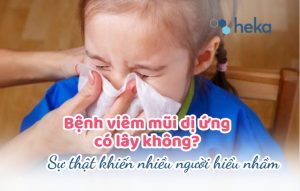 Bệnh Viêm Mũi Dị ứng Có Lây Không? Sự Thật Khiến Nhiều Người Hiểu Nhầm