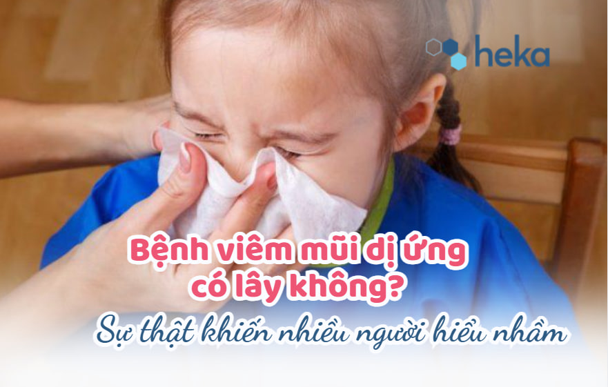 Bệnh Viêm Mũi Dị ứng Có Lây Không? Sự Thật Khiến Nhiều Người Hiểu Nhầm