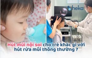 HÚt MŨi NỘi Soi Cho TrẺ KhÁc GÌ VỚi HÚt RỬa MŨi ThÔng ThƯỜng