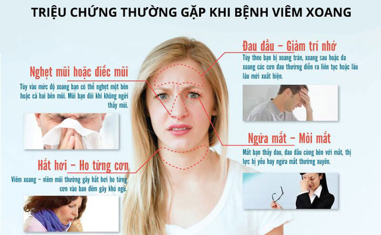 Làm Thế Nào Khi Mang Thai Bị Viêm Xoang? Hướng Xử Lý An Toàn Cho Mẹ Bầu