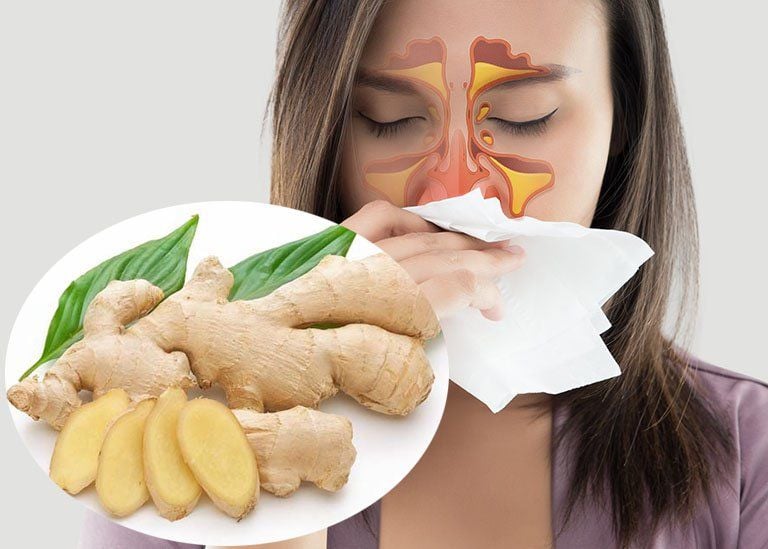 Xông Gừng Trị Viêm Xoang Có Hiệu Quả Không?