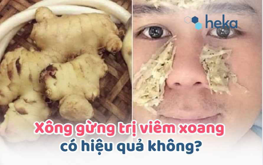 Xông Gừng Trị Viêm Xoang Có Hiệu Quả Không?