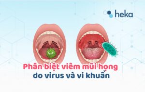 Phân Biệt Viêm Mũi Họng Do Virus Hoặc Vi Khuẩn