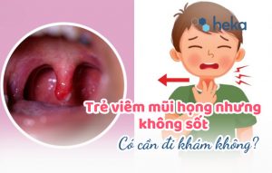 Trẻ Viêm Mũi Họng Nhưng Không Sốt: Có Cần đi Khám Không?