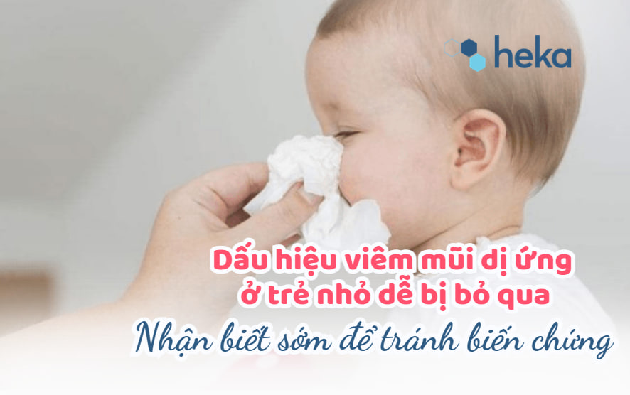 Dấu Hiệu Viêm Mũi Dị ứng ở Trẻ Nhỏ Dễ Bị Bỏ Qua