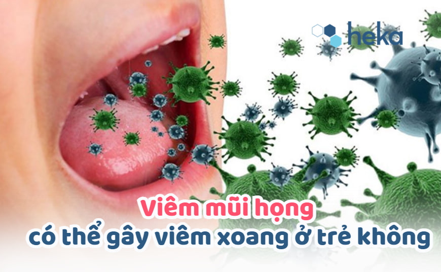 Viêm Mũi Họng Có Thể Gây Viêm Xoang ở Trẻ Không