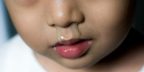 4 cách khắc phục bé bị sổ mũi xanh tại nhà hiệu quả